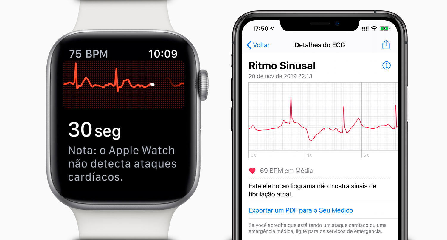 [hack] Activating the Apple Watch ECG in Brazil Unofficially