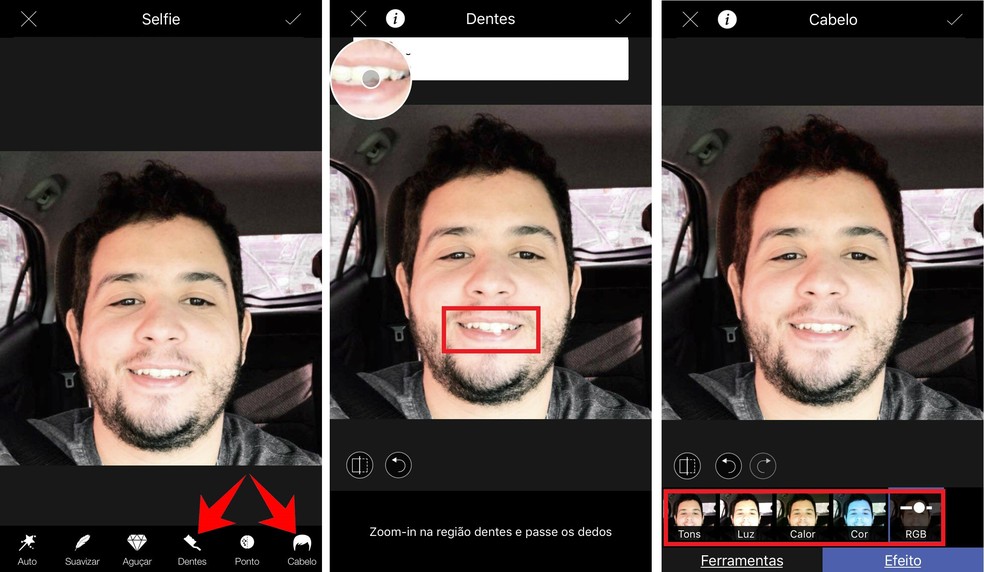 Accentuate white teeth and change hair color with the LightX app Photo: Reproduction / Rodrigo Fernandes