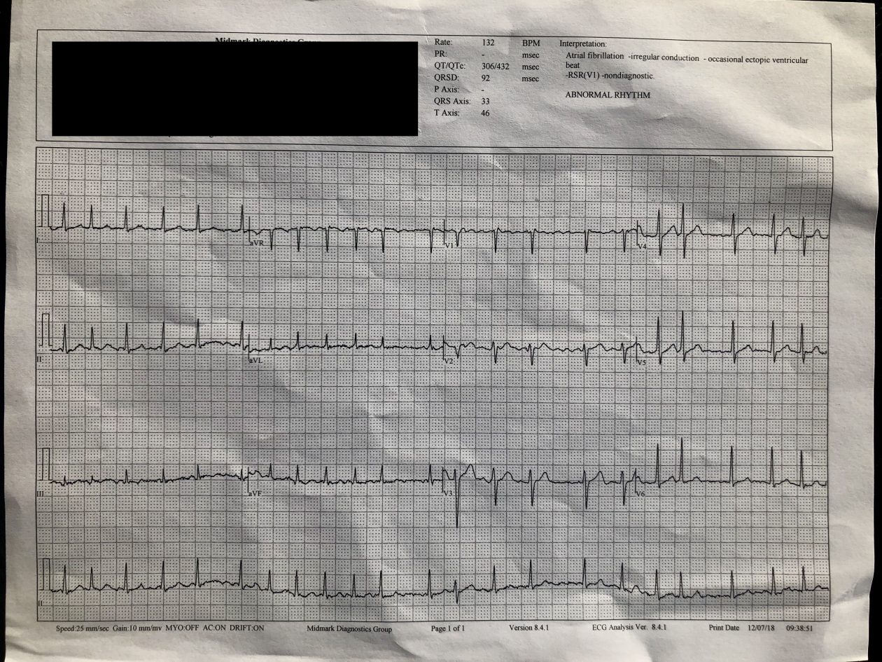 ECG performed by the hospital